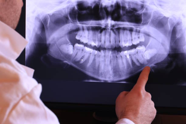 Best Emergency Root Canal Treatment in Trucksville, PA